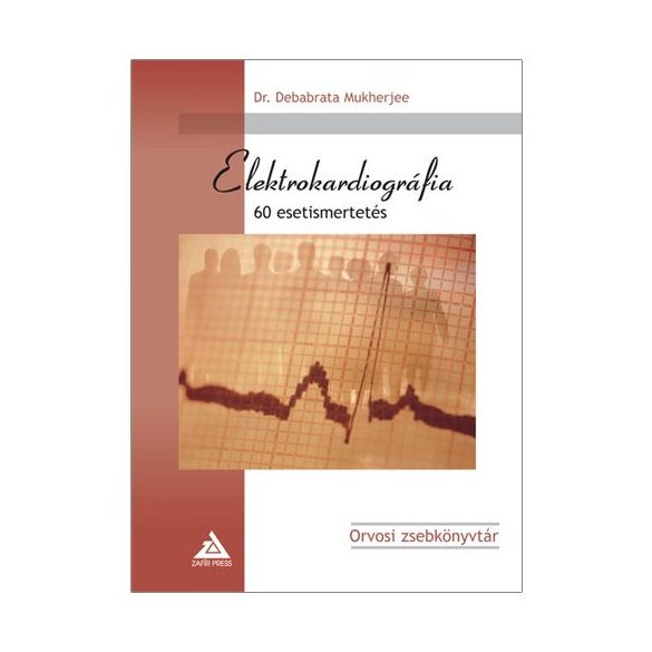 Elektrokardiográfia - 60 esetismertetés