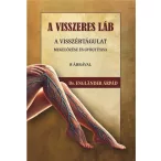   A visszeres láb a visszértágulat megelőzése és gyógyítása