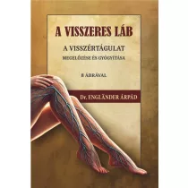   A visszeres láb a visszértágulat megelőzése és gyógyítása