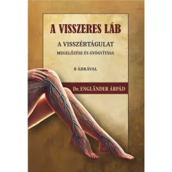   A visszeres láb a visszértágulat megelőzése és gyógyítása